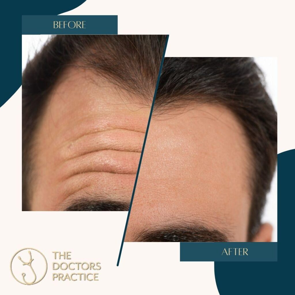 Aesthetic Treatments for Men