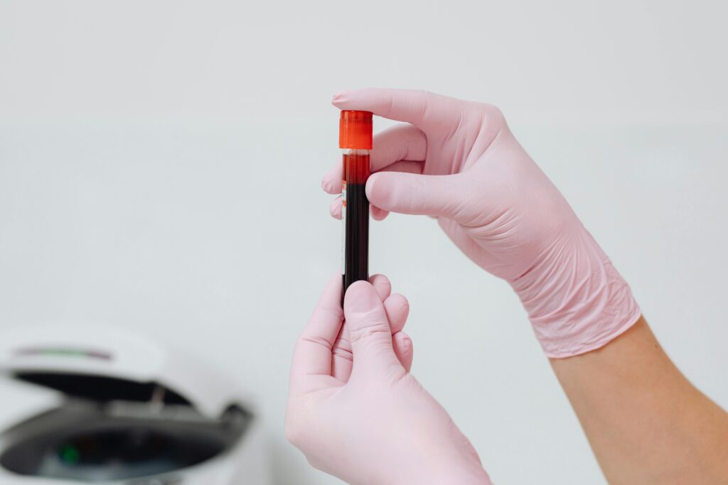 Why You Can Feel Unwell With “Normal” Blood Tests: What Reference Ranges Miss