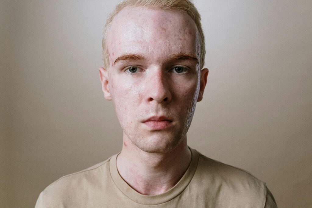 Aesthetic Treatments for Men