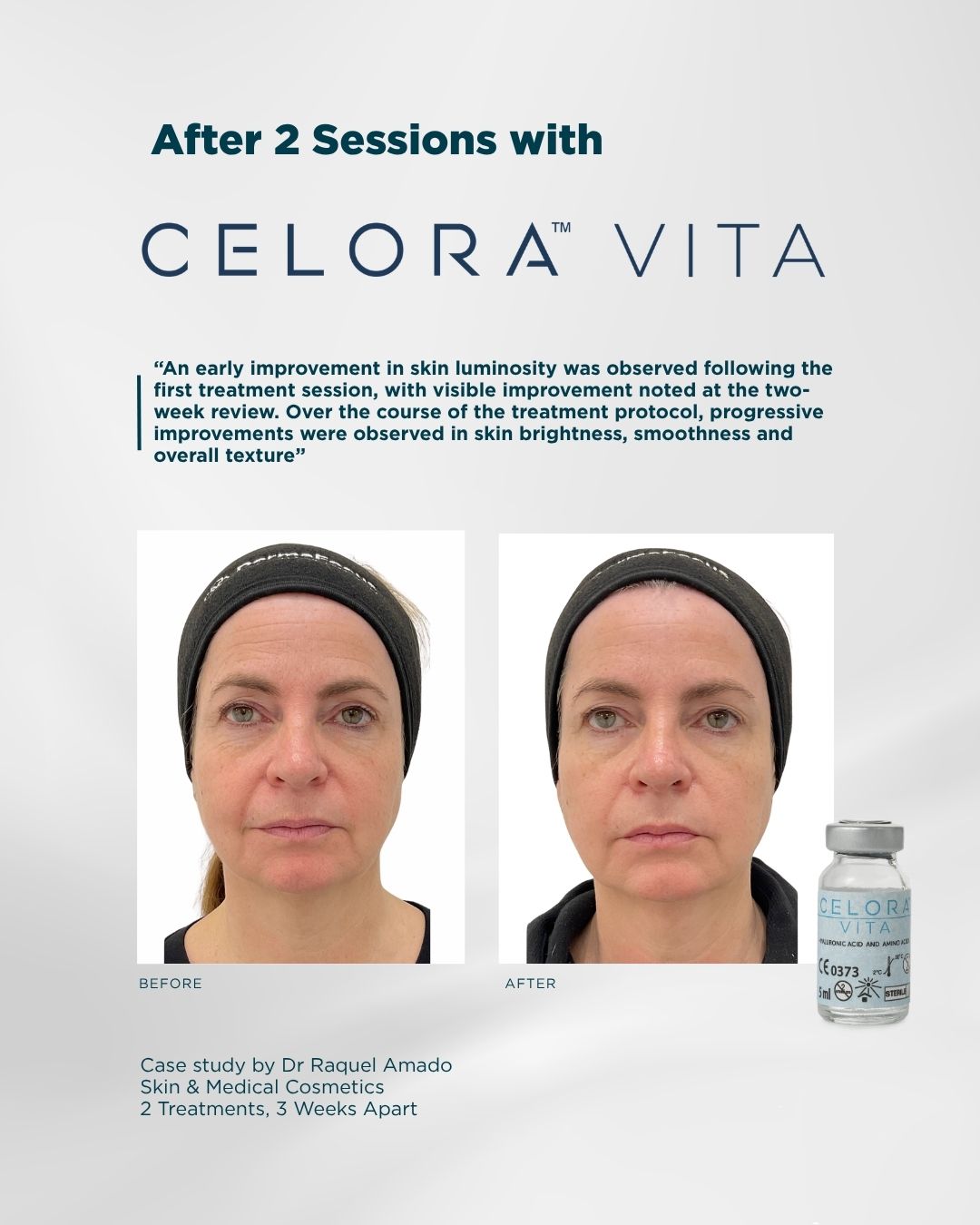 before and after celora