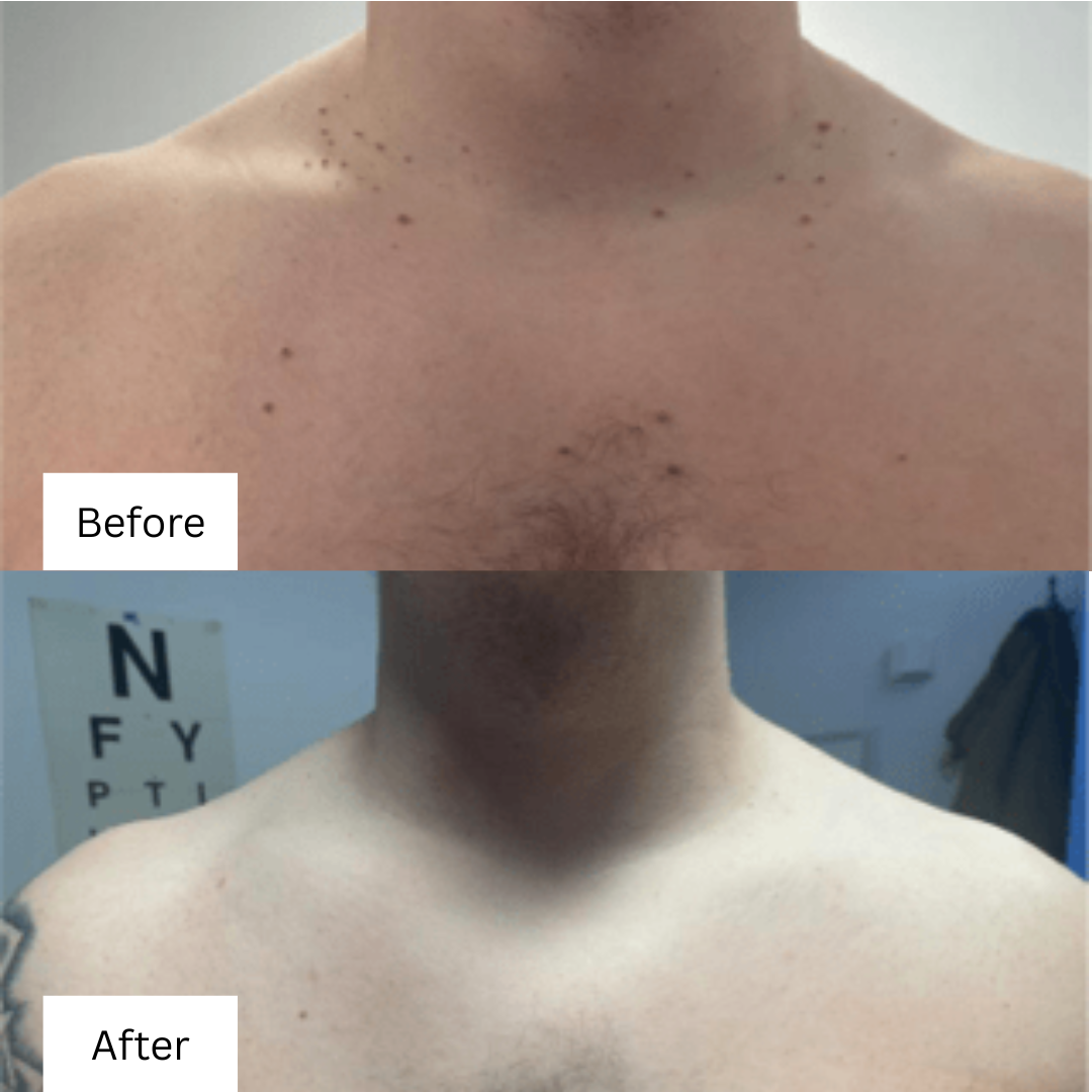 before and after minor surgery 2