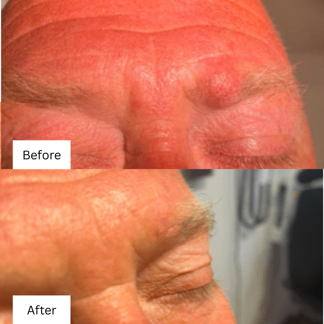 before and after minor surgery 3