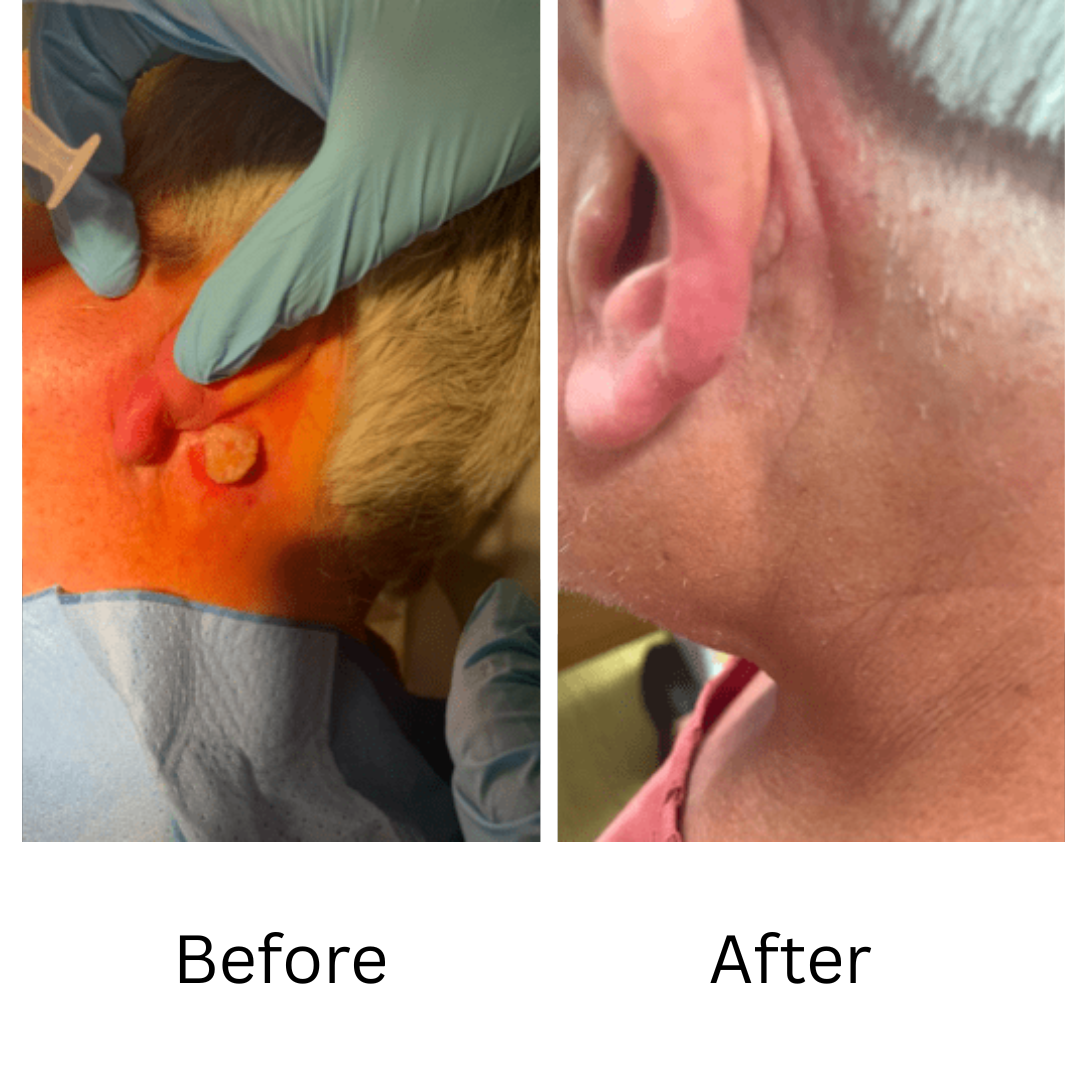 before and after minor surgery