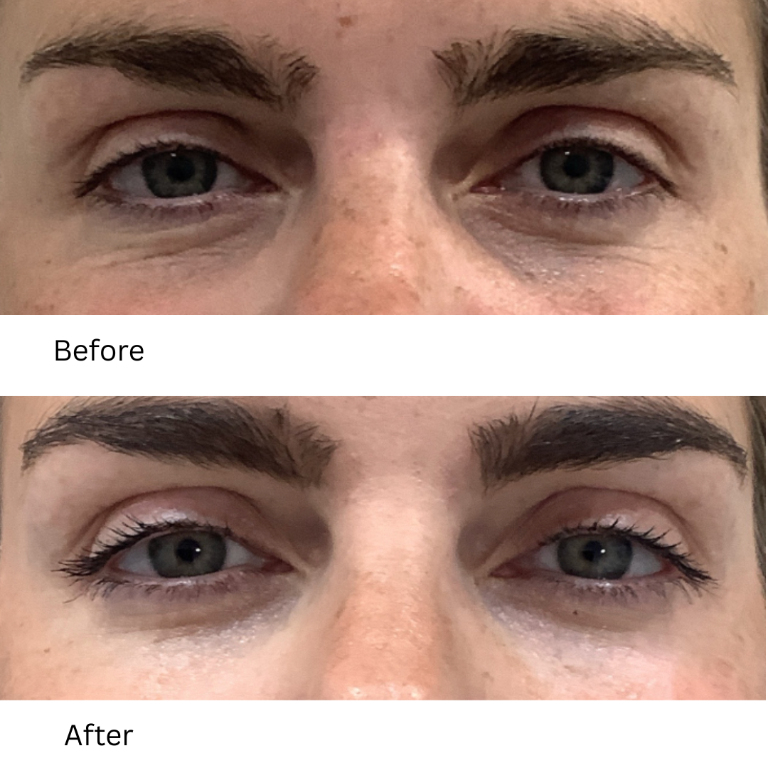 before and after polynucleotides Birmingham