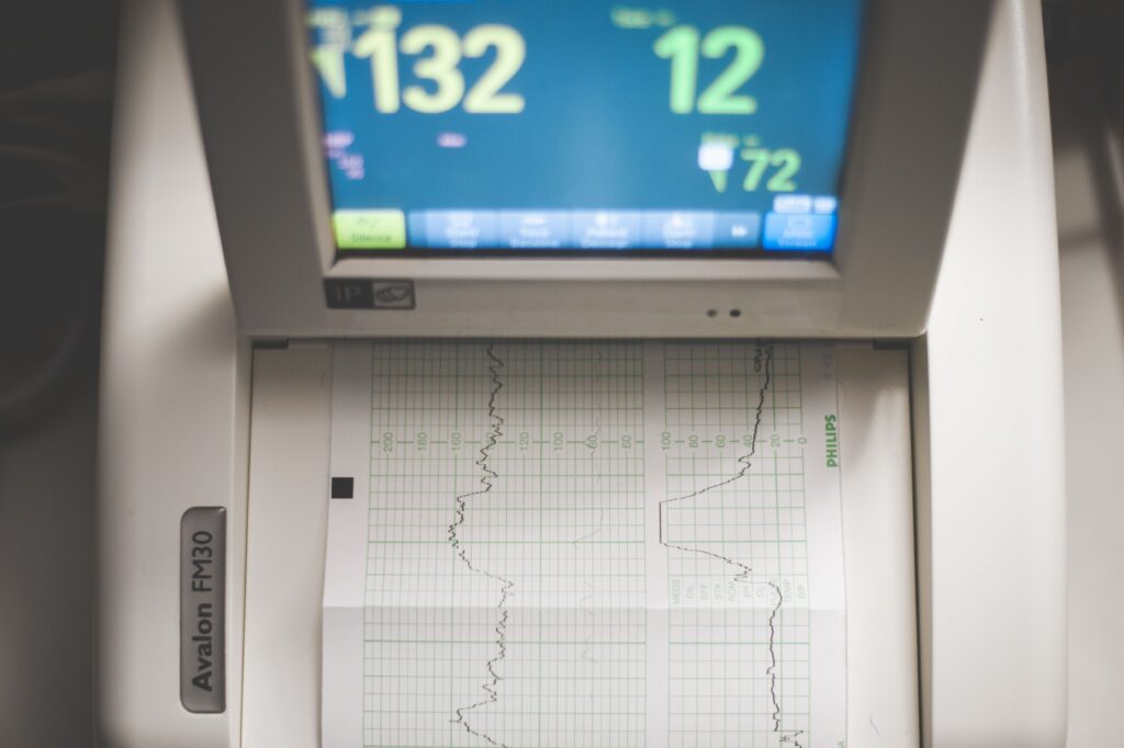 private ecg birmingham