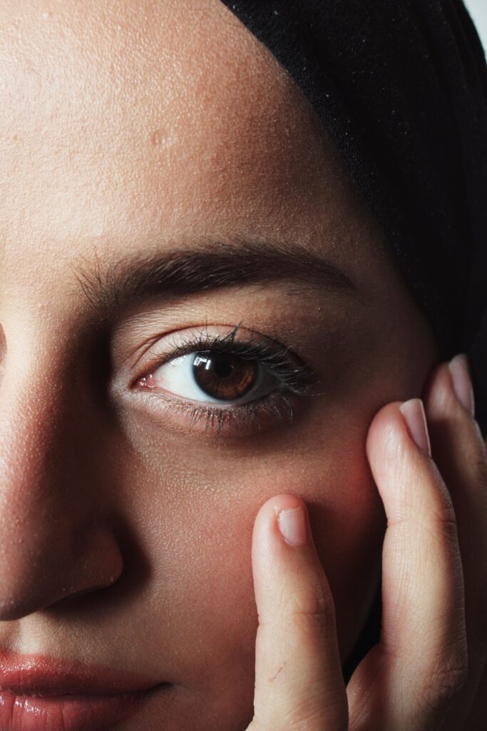 Topical Steroid Withdrawal
